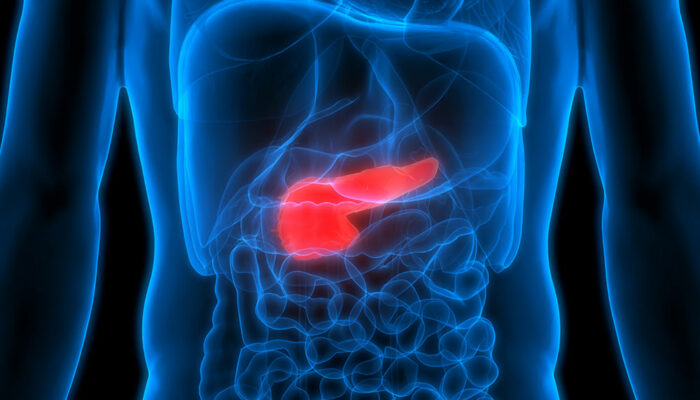 3 Treatment Options for Pancreatic Cancer