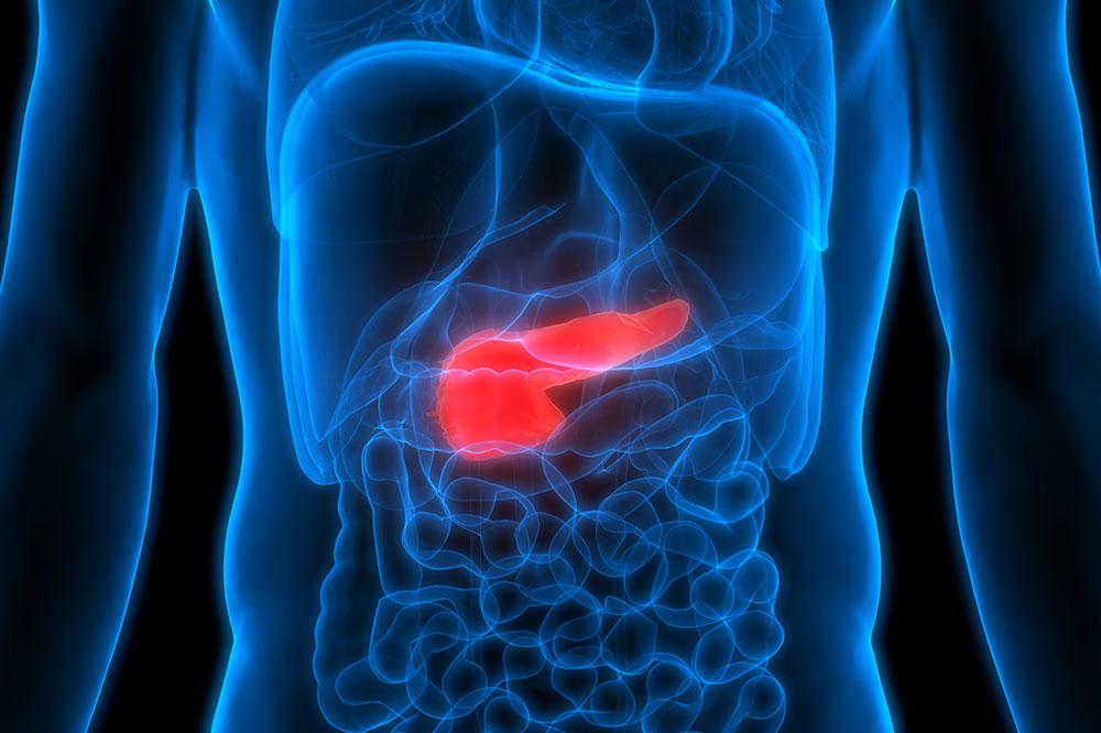 3 Treatment Options for Pancreatic Cancer