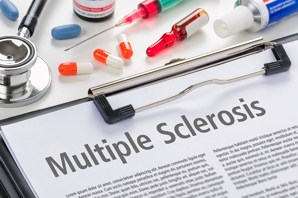 5 Treatment Options for Multiple Sclerosis