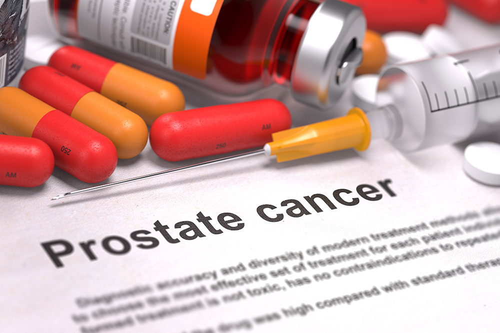 Diagnosis and Stages of Prostate Cancer
