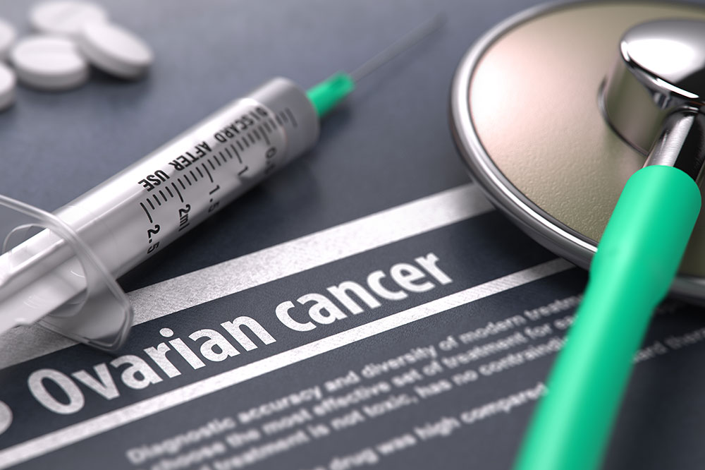 Stages and Risk Factors for Ovarian Cancer